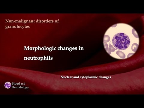 Nuclear and cytoplasmic changes in neutrophils