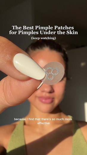 Effective Acne Treatment with Microneedle Patches