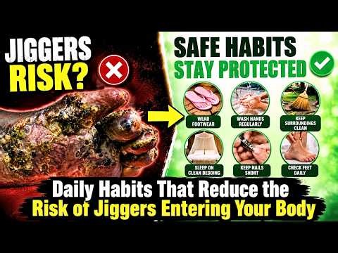 Daily Habits That Reduce the Risk of Jiggers Entering Your Body