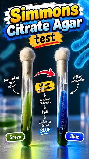 Citrate Utilization Test Microbiology | Simmons Citrate Agar | Principle & Positive Result