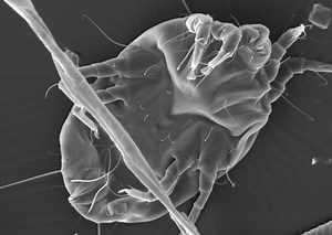 Why Dust Mite Allergens Make You Sneeze | Immunology