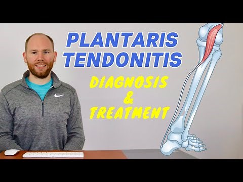 Plantaris Muscle Pain | Plantaris Rupture and Plantaris Tendonitis