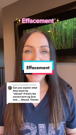 Understanding Effacement and Its Meaning in Pregnancy