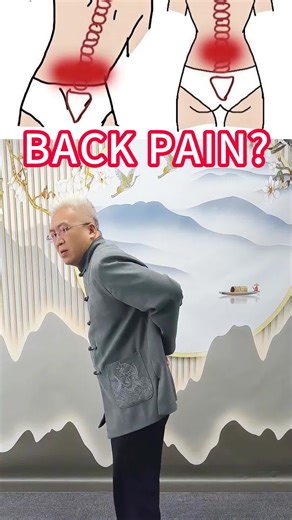 腰痛 back pain#腰痛 #backpain #tcm #fyp