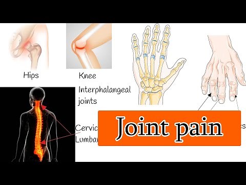Osteoarthritis - Joint Pain and Stiffness, Osteoarthritis Symptoms and treatment