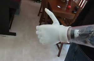 World's first bionic hands.