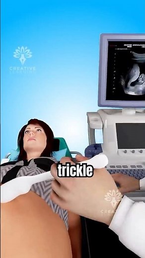 Your Water Broke… Too Early 😳#pregnancy
