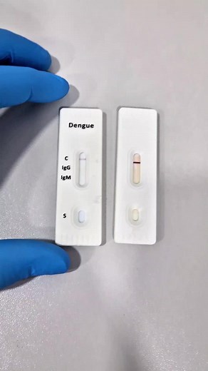 Teste de Dengue: Diferenças entre NS1 e IgM/IgG