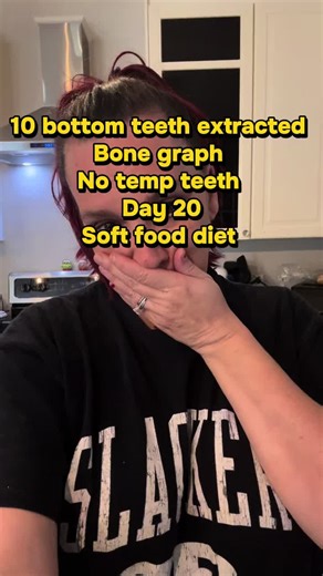 Soft, comforting, and easy—Uncle Phil’s Supper is my go-to crockpot meal on my dental implant journey. Perfect for anyone craving soft food that still feels like home-cooked comfort! #DentalImplantJourney #SoftFoodRecipe #CrockpotComfort #EasySoftMeals #UnclePhilsSupper