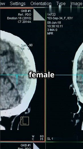 Brain Battle: The Scientific Differences Between Male and Female Minds