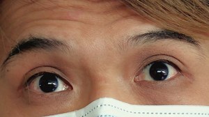 Neurology: Pupillary Light Response and RAPD (Yi Chang)