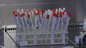 Labore bei PCR-Test-Auswertung am Limit