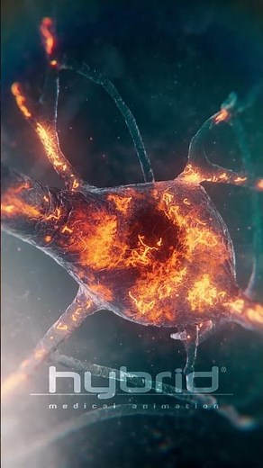 Tau & neurofibrillary tangles animation | Alzheimer’s disease | medical animation | toxic aggregates