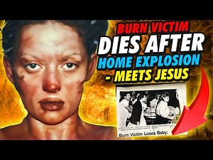 Near Death Experience: Burn Victim Dies After Home Explosion - Meets Jesus