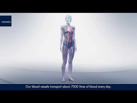 Medical Animation Movie on Venous Disorders