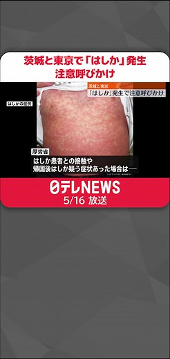 #茨城県 と#東京都 内で相次いで「#はしか 」の発生が確認され、#厚生労働省 は注意を呼びかけています。#日テレnews #tiktokでニュース