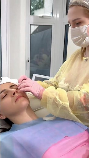 Foxy Eyes with PDO Threads ✨