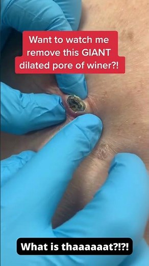 Wait for it…. 😁
