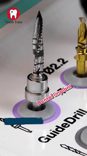 Dental Implant #dentalimplants #dentalimplantprocess #teethtube #fyp #dentalstudent