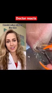 Doctor reacts: shaving HUGE foot callus | Footdocdana