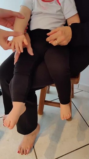 Pronation douloureuse de l'enfant : hyperpronation (ou pronation forcée)