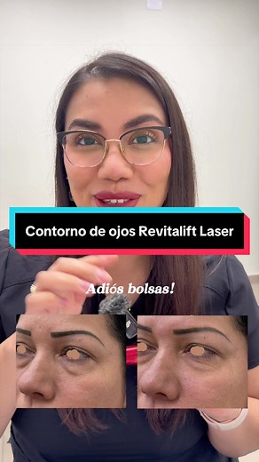 Transforma tus ojos en 15 minutos con Revitalift Láser