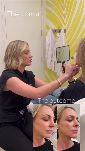 A good injector doesn’t just inject. They listen. Every treatment starts with an individualized consult— so your results fit your goals, not someone else’s. #FriscoInjector #AestheticConsult #NaturalResults #GracefulAging #FriscoMedSpa