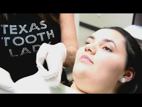 Houston Cosmetic Dentist...Step by Step procedure on Snap-on Smile!