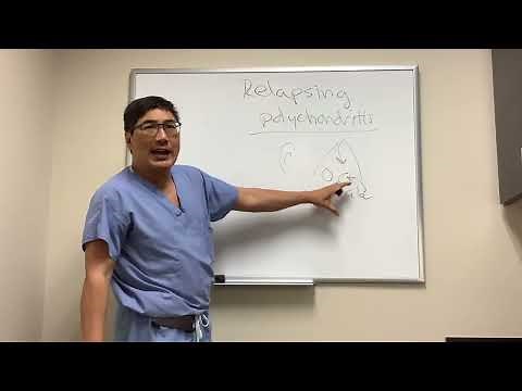 Relapsing polychondritis