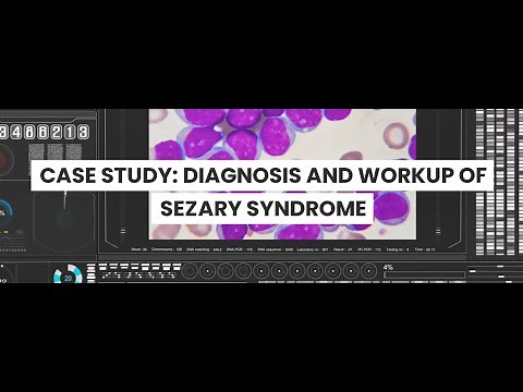 Diagnostic Evaluation of Sezary Syndrome: A Case Study of workup and diagnosis of T-cell leukemia