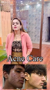 Acne Care ☎️ 9717753613 Add- CSC Market, Sec-18B, Dwarka, New Delhi - 110078 #Facial #Skincare #BeautyTips #GlowUp #FacialTreatment SkincareRoutine SelfCare | Nisha Lambha - Sparsh Beauty Care & Hair Treatment LLP