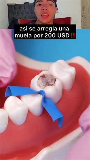 Affordable Tooth Repair for Just $200