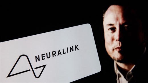 Elon Musk assure que Neuralink lancera la production à grande échelle de ses implants cérébraux en 2026