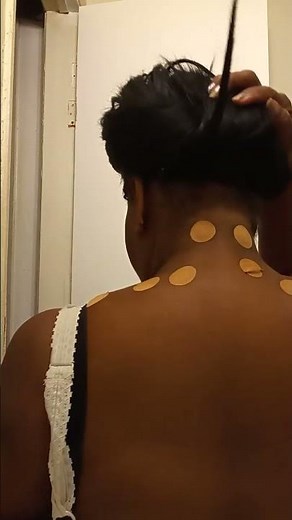 Neck 🧣 Injection Whip Lash..Pain Dr.