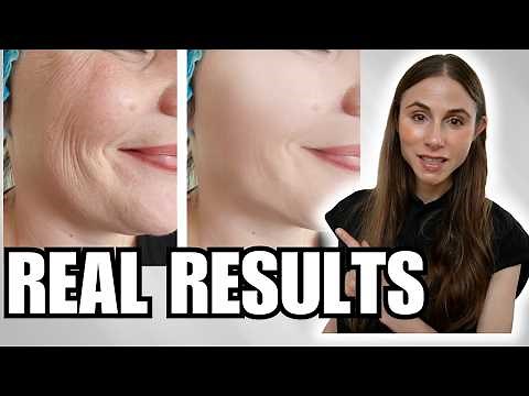Sculptra, CO2 Laser, Red Light Therapy: What Really Improves Skin Aging?