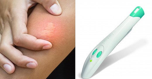 Mückenstiche mit Hitze behandeln: Unsere Erfahrungen mit dem elektronische Stichheiler Bite-Away