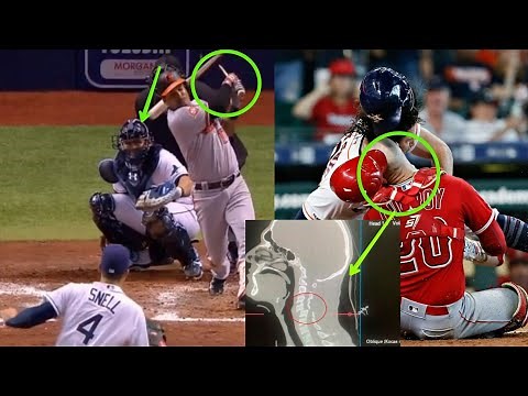 MLB | Catchers Injuries, and hit by the ball