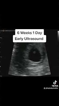 Heartbeat on Early Ultrasound at 6 Weeks 1 Day Pregnant