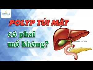 Gallbladder polyps, do I need surgery?