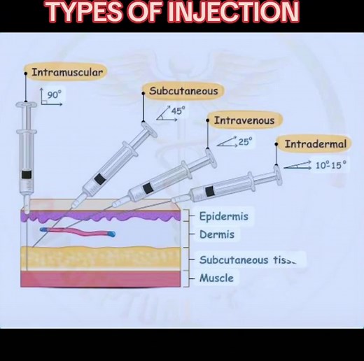 StudySkills Types of Injection 💉💉💉 #viewsproblem #unfreezemyaccount #foryou #types_of_injection #normallifeneed🙏🏽🥺🤷🏼‍♀️