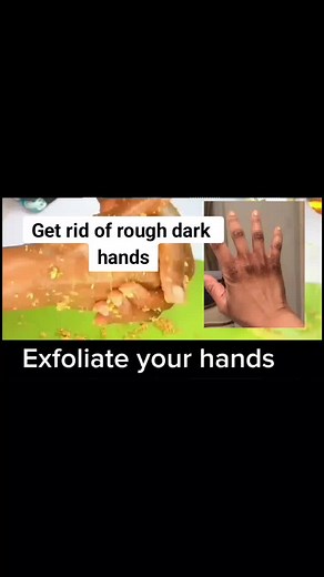Get Rid of Dark Knuckles and Dry Hands with Homemade Skincare