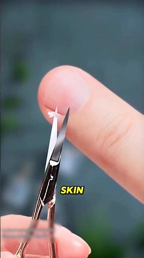 Never Pull Off Peeling Skin Around Your Nails!