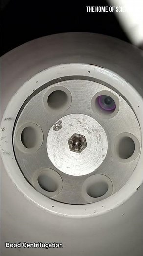 The Art of Centrifugation: Dividing Blood's Components