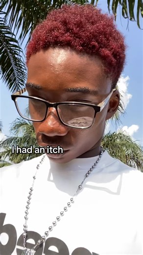 How I Dealt with an Itch on My Bald Head