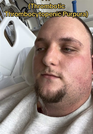 Raising Awareness for TTP and Autoimmune Diseases