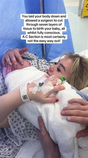 A caesarean is never the “easy way out.” It is birth.