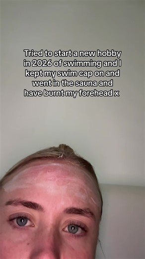 Swim Cap Tips: Avoiding Sauna Sunburns while Swimming