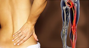 The 4 Best Exercises to Help Beat Your Sciatica Symptoms