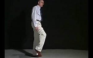 跨域步态（steppage gait）