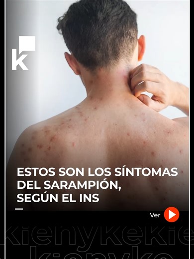 Diana Pava, directora del Instituto Nacional de Salud, explicó cuál es el panorama actual de sarampión en Colombia. Además, entregó detalles de los síntomas y signos de alarma de esta enfermedad. #Sarampión #INS #Salud #Bogotá